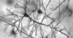 What Causes Déjà Vu? The Science Behind That Eerie Feeling