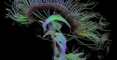 Why Can't You Tickle Yourself? Your Brain Is One Step Ahead