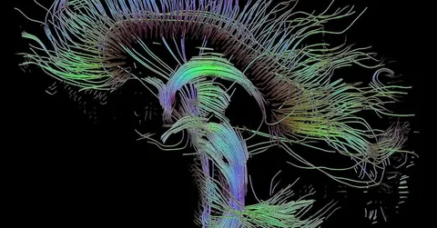 Why Can't You Tickle Yourself? Your Brain Is One Step Ahead